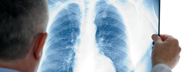 2012 Ziua Pneumologiei